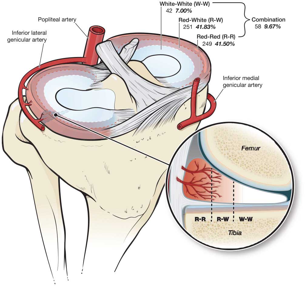 Physiotherapy Adelaide indicating meniscus anatomy